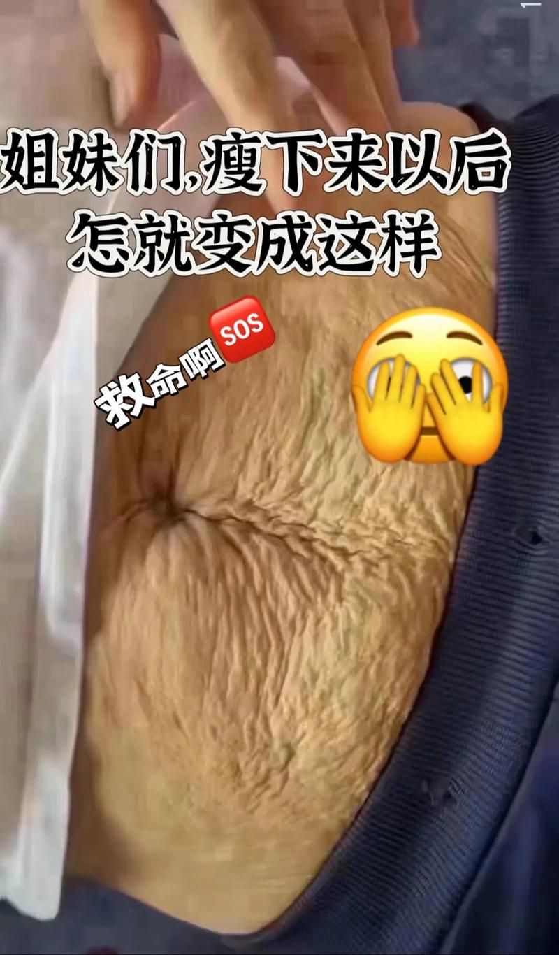 告别大肚皮，健康减肥的实用技巧分享