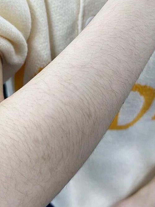 多毛女是怎样一种体验？真实感受大揭秘！
