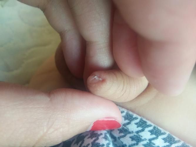 小鸡排出白色液体正常吗？生理现象还是疾病信号？