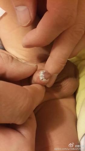 小鸡排出白色液体正常吗？生理现象还是疾病信号？