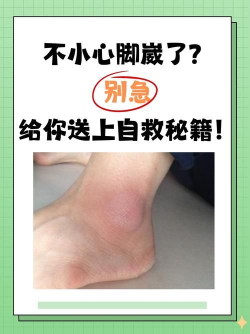 崴脚后容易再崴脚？蚂蚁庄园告诉你答案！