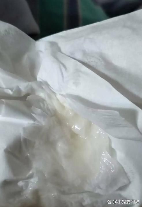 性生活后流白色液体是正常现象吗？你需要了解这些