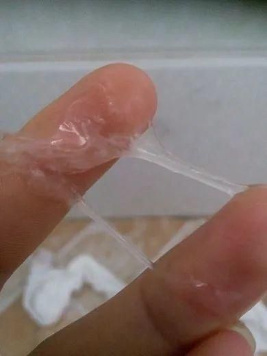性生活后流白色液体是正常现象吗？你需要了解这些