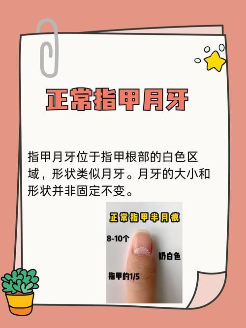 指甲月牙大小与健康的关系，你真的了解吗？