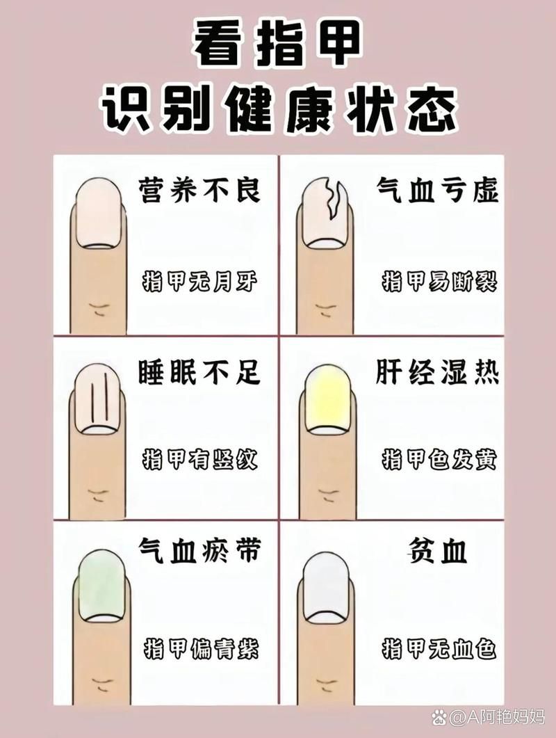 指甲月牙大小与健康的关系，你真的了解吗？