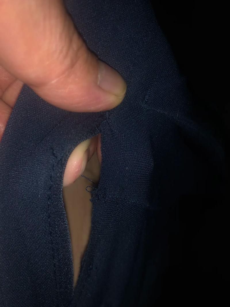 烂裤裆的危害有哪些？及早发现及早治疗