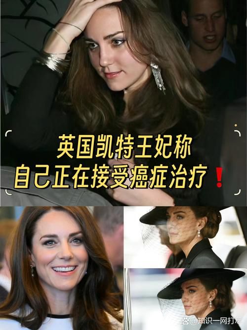 凯特王妃最新消息：癌症治疗进展顺利，恢复良好